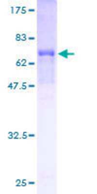 12.5% SDS-PAGE Stained with Coomassie Blue.