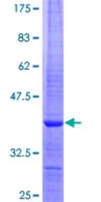 12.5% SDS-PAGE Stained with Coomassie Blue.