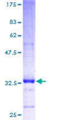 Recombinant Human EML4 Protein [H00027436-P01] - 12.5% SDS-PAGE Stained with Coomassie Blue.