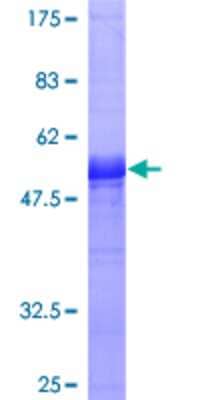 Other Recombinant Human PR48 GST (N-Term) Protein