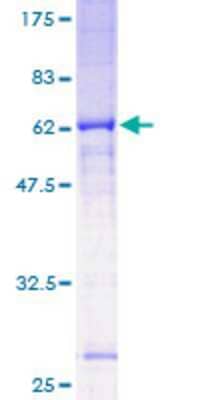 12.5% SDS-PAGE Stained with Coomassie Blue.