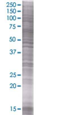 TRDD3 transfected lysate