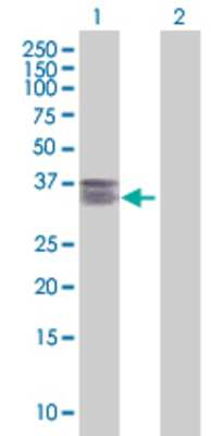 Lane 1: TRDD3 transfected lysate (32.67 KDa). Lane 2: Non-transfected lysate.