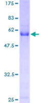 Other Recombinant Human DEXI GST (N-Term) Protein
