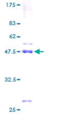 12.5% SDS-PAGE Stained with Coomassie Blue.