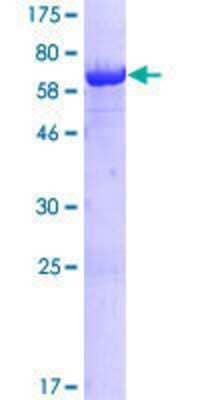 12.5% SDS-PAGE Stained with Coomassie Blue.