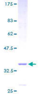 12.5% SDS-PAGE Stained with Coomassie Blue.
