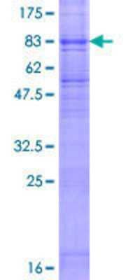 12.5% SDS-PAGE Stained with Coomassie Blue.