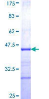 12.5% SDS-PAGE Stained with Coomassie Blue.