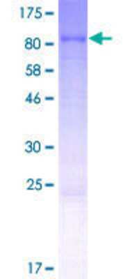 SDS-Page: Recombinant Human ASTE1 Protein [H00028990-P01] - 12.5% SDS-PAGE Stained with Coomassie Blue.