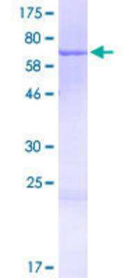 12.5% SDS-PAGE Stained with Coomassie Blue.