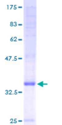 12.5% SDS-PAGE Stained with Coomassie Blue.