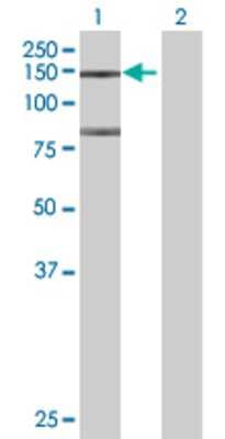 Lane 1: FHOD1 transfected lysate (126.6 KDa) Lane 2: Non-transfected lysate.