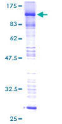 12.5% SDS-PAGE Stained with Coomassie Blue.