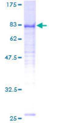 12.5% SDS-PAGE Stained with Coomassie Blue.