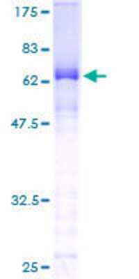 12.5% SDS-PAGE Stained with Coomassie Blue.