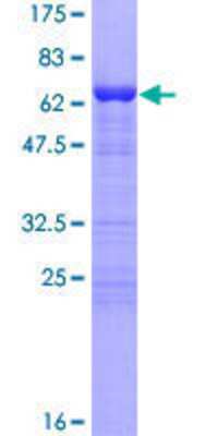 12.5% SDS-PAGE Stained with Coomassie Blue.