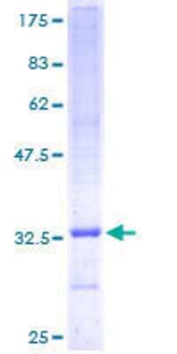 12.5% SDS-PAGE Stained with Coomassie Blue.