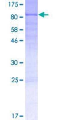 12.5% SDS-PAGE Stained with Coomassie Blue.