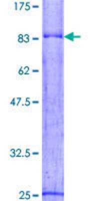 12.5% SDS-PAGE Stained with Coomassie Blue.