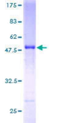 12.5% SDS-PAGE Stained with Coomassie Blue.