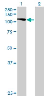 Lane 1: DSE transfected lysate (105.49 KDa) Lane 2: Non-transfected lysate.