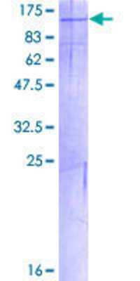 SDS-Page: Recombinant Human PKN3 Protein [H00029941-P01] - 12.5% SDS-PAGE Stained with Coomassie Blue.