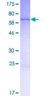 12.5% SDS-PAGE Stained with Coomassie Blue.