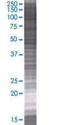 OSGIN1 transfected lysate.