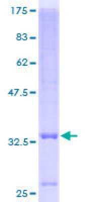 Other Recombinant Human SLC39A3 GST (N-Term) Protein