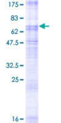 12.5% SDS-PAGE Stained with Coomassie Blue.