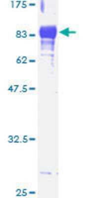 12.5% SDS-PAGE Stained with Coomassie Blue.