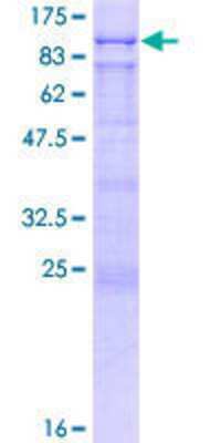 12.5% SDS-PAGE Stained with Coomassie Blue.