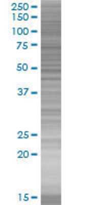 BAZ2B transfected lysate.