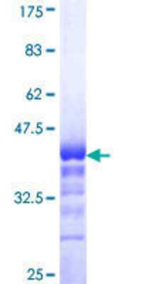 SDS-Page: Recombinant Human TLX3 Protein [H00030012-Q01] - 12.5% SDS-PAGE Stained with Coomassie Blue.
