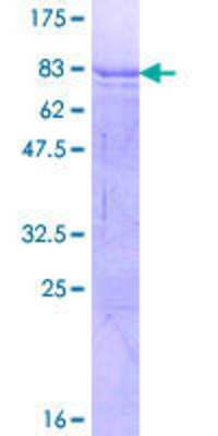 12.5% SDS-PAGE Stained with Coomassie Blue.