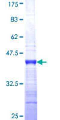 12.5% SDS-PAGE Stained with Coomassie Blue.