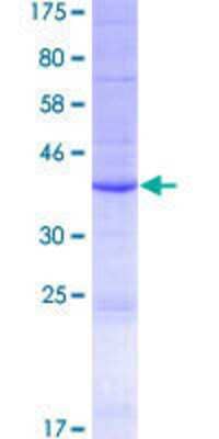 Other Recombinant Human Phospholipase A2 IIE GST (N-Term) Protein