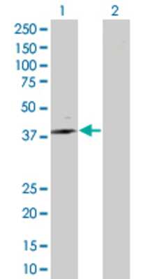 Lane 1: ST6GALNAC6 transfected lysate (36.74 KDa) Lane 2: Non-transfected lysate.