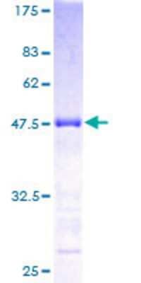 12.5% SDS-PAGE Stained with Coomassie Blue.