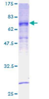 12.5% SDS-PAGE Stained with Coomassie Blue.