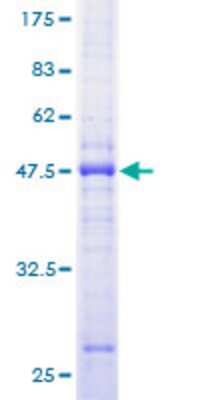 12.5% SDS-PAGE Stained with Coomassie Blue.