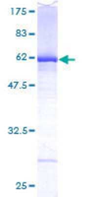 12.5% SDS-PAGE Stained with Coomassie Blue.