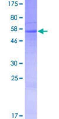 Other Recombinant Human retinol dehydrogenase 8 (all trans) GST (N-Term) Protein