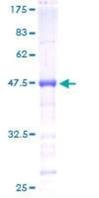 12.5% SDS-PAGE Stained with Coomassie Blue.