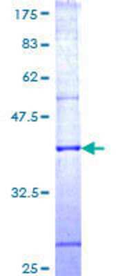 12.5% SDS-PAGE Stained with Coomassie Blue.
