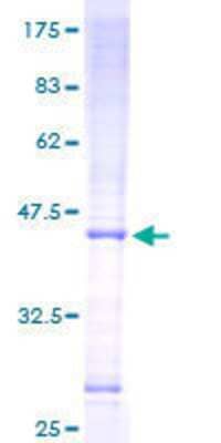 12.5% SDS-PAGE Stained with Coomassie Blue.