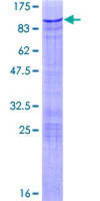 12.5% SDS-PAGE Stained with Coomassie Blue.