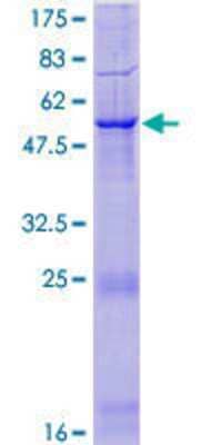 SDS-Page: Recombinant Human Protease Inhibitor 15 Protein [H00051050-P01] - 12.5% SDS-PAGE Stained with Coomassie Blue.