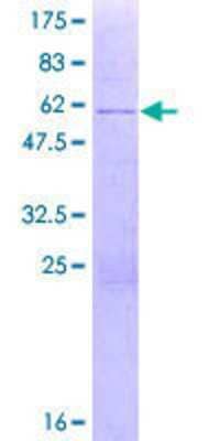 12.5% SDS-PAGE Stained with Coomassie Blue.